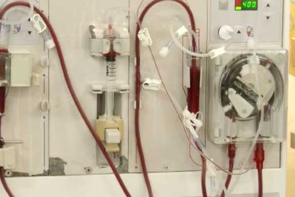 Image of dialysis machine